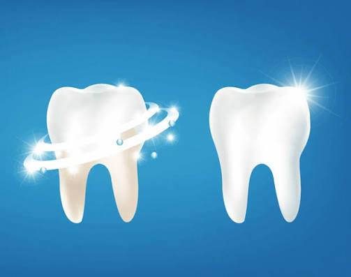 Enjuágate la boca después de cada comida.